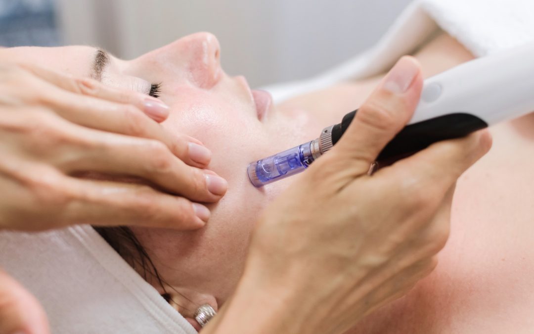 Micro Needling Course