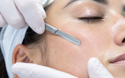 Dermaplaning