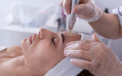Microneedling Masterclass